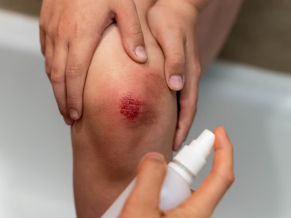 Quais são os remédios eficazes para cicatrizar feridas profundas?
